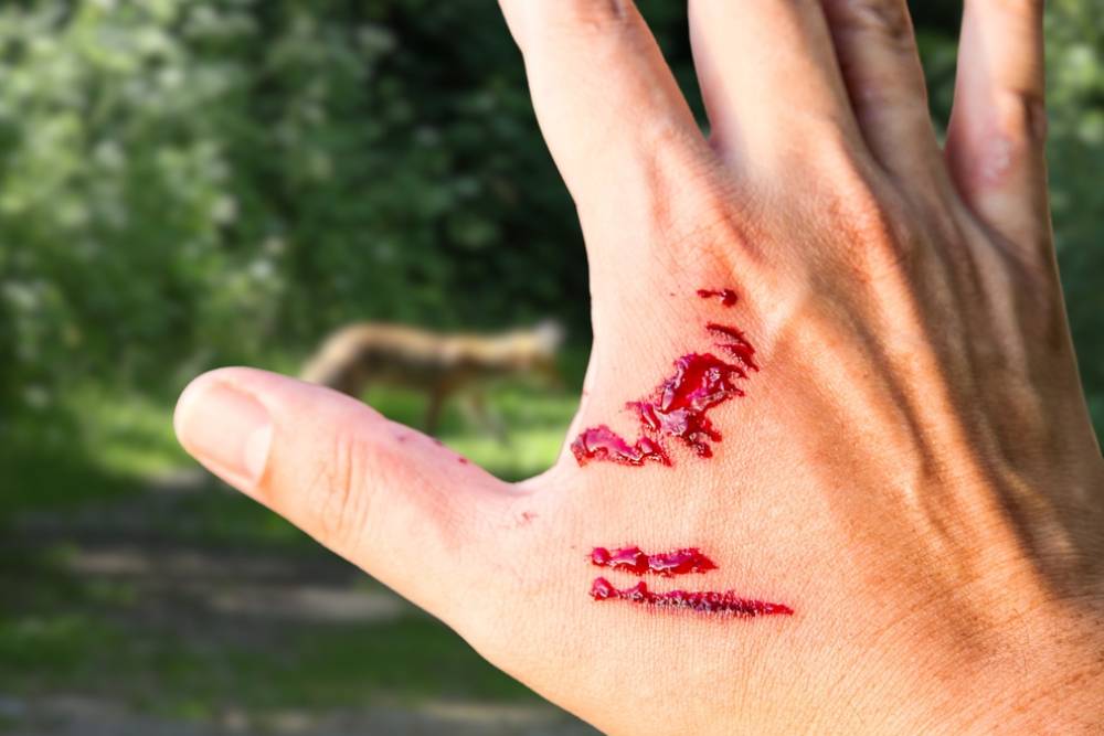 A dog bite wound and blood on hand. Infection and Rabies concept.Sarting of Rabies.